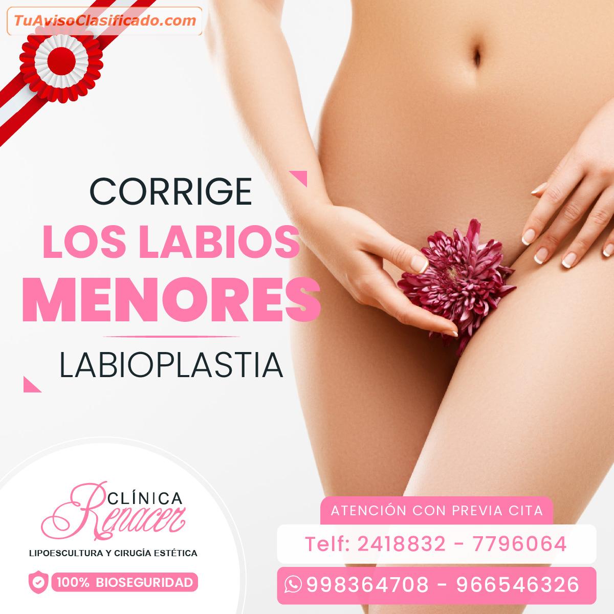 Cirugía Intima Labioplastia Servicios Y Comercios Salud Y B 3641